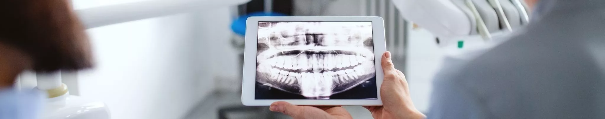 Endodontic Treatments 