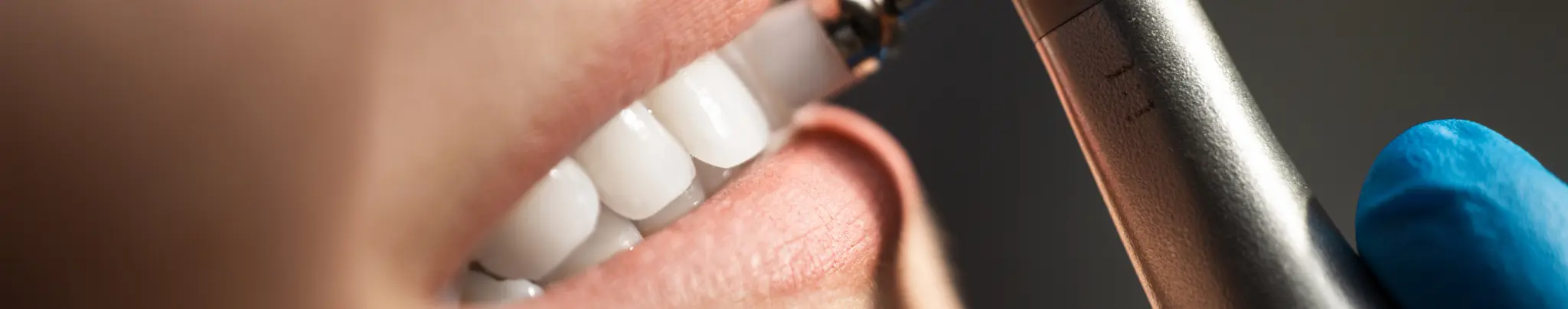 family dentistry