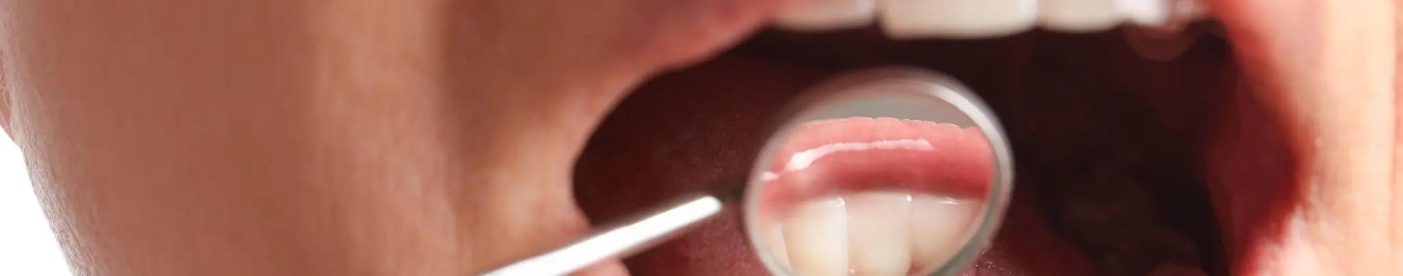 oral cancer awareness