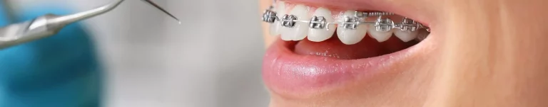 orthodontics