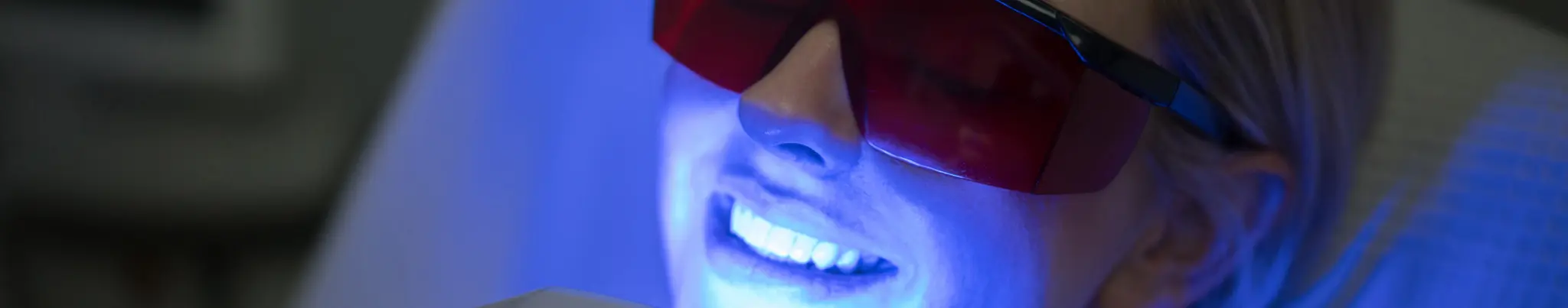 professional teeth whitening 