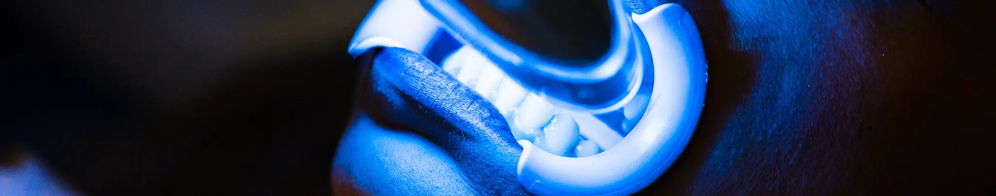teeth whitening